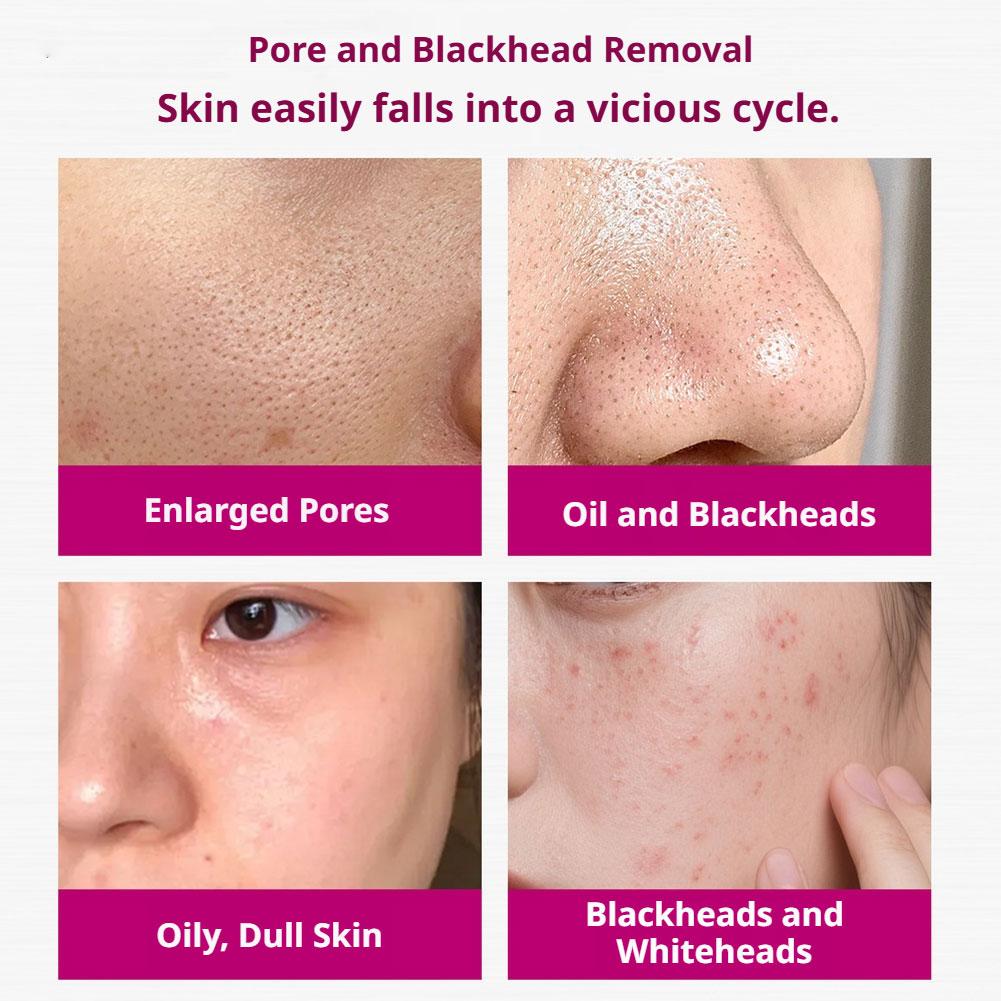 Serum Asam Salisilat Mengecilk - Aha Bha Exfoliant ulasan dan harga