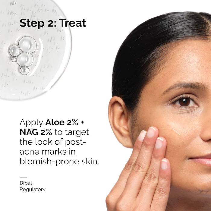 Serum Aloe 2% + NAG 2% 30ml un - Aha Bha Exfoliant ulasan dan harga