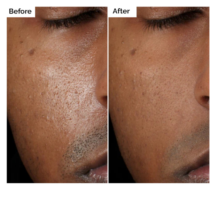 Serum Aloe 2% + NAG 2% 30ml un - Aha Bha Exfoliant ulasan dan harga